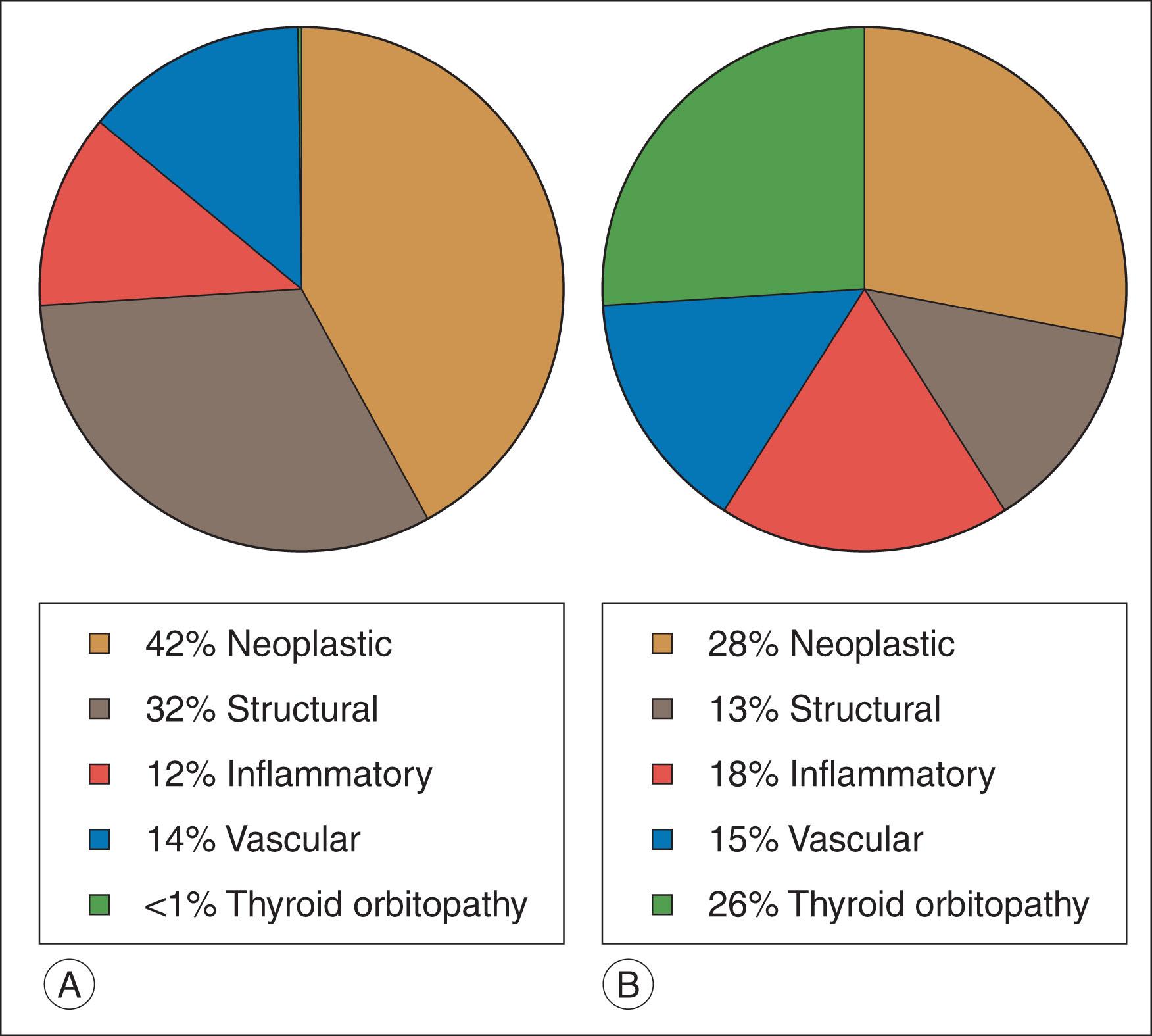 Fig. 19.4, (A) Distribution of orbital disease in patients less than 11 years of age. (B) Distribution of orbital disease in patients 11–17 years.