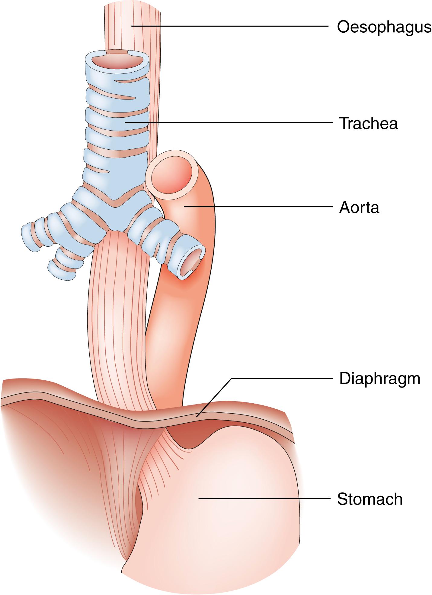 Fig. 14.1, Anatomic relationships of the oesophagus.