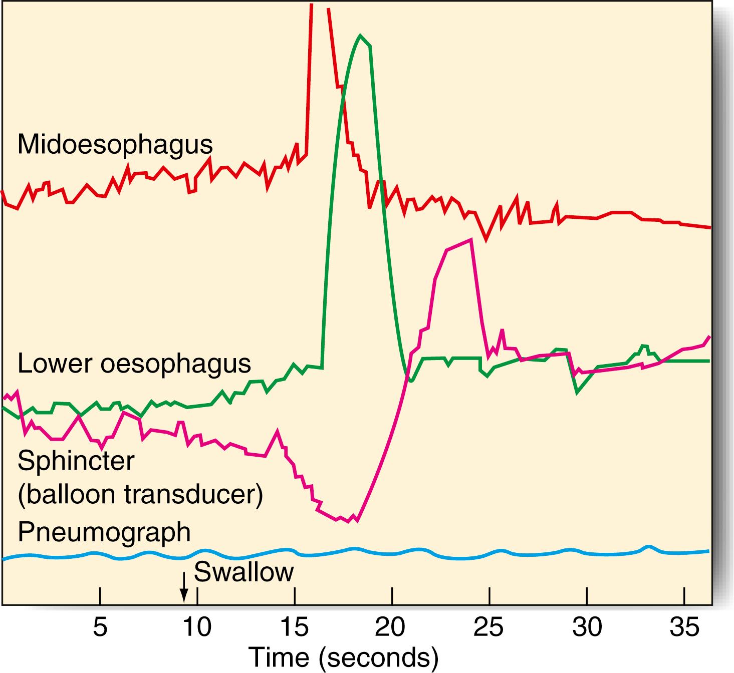 Fig. 14.10, Recording of the intraluminal pressure of the oesophagus.