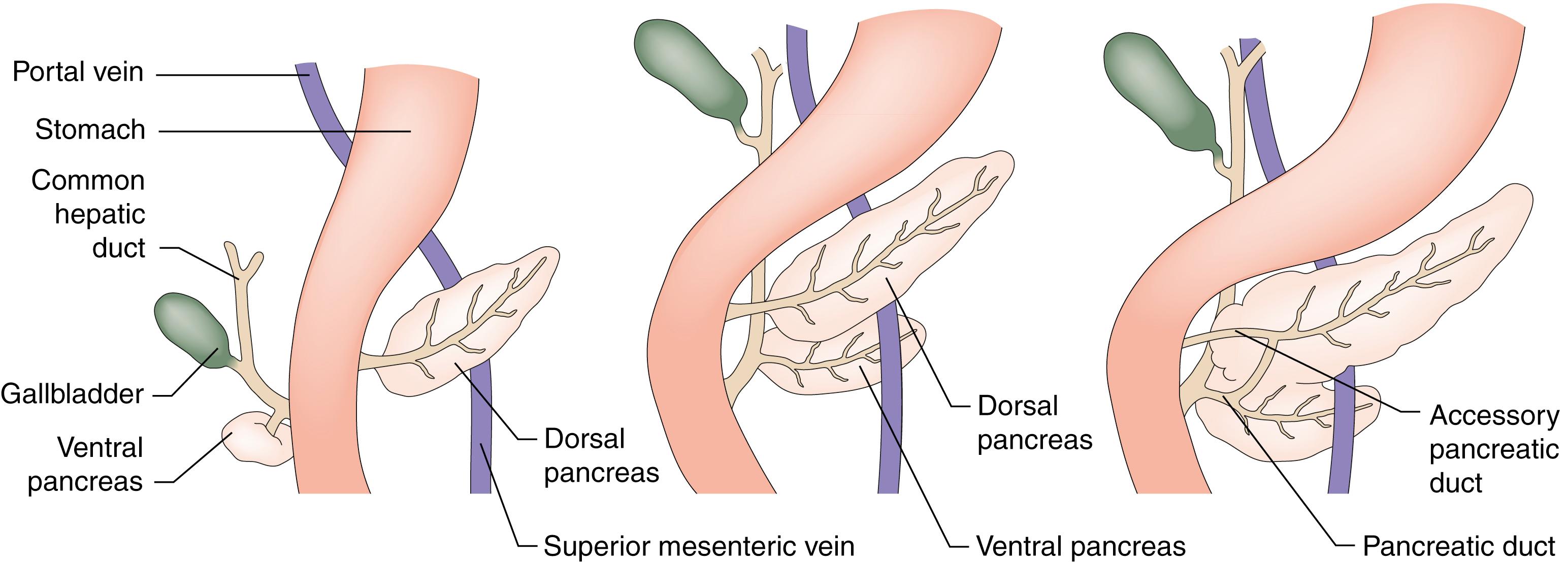 Fig. 16.1, Development of the pancreas.