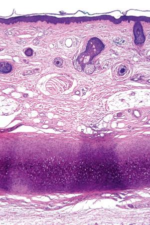 Fig. 1.15, Skin from the ear: note the vellus hairs, and a fairly thin dermis overlying the auricular cartilage.