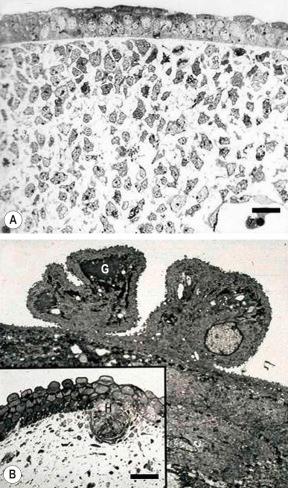 Fig. 1.21, ( A , B ) Development of normal human fetal skin: ( A ) at 7 weeks' gestation, the epidermis is only two cell layers thick but the dermis appears very cellular; ( B ) at 19 weeks' gestation the skin has an outer layer specific to mammals known as periderm. This contains surface blebs which are full of glycogen ( G ). Also present is a hair peg ( H ). This downgrowth of the epidermis is the first histologic step in generating a hair follicle. Bar = 25 µm.