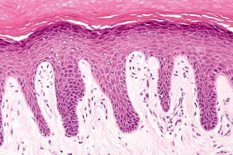 Fig. 1.3, Skin from palm: there is a conspicuous granular cell layer.