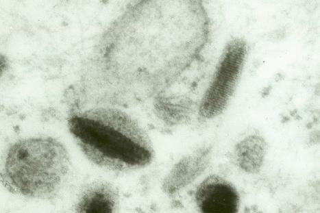 Fig. 1.37, Melanosome: note the typical striated internal structure.