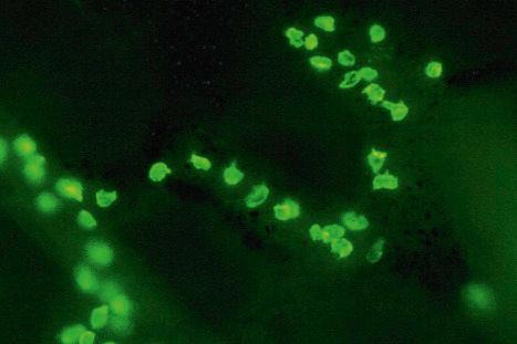 Fig. 1.41, Merkel cells: separated human epidermis showing a striking linear arrangement (troma-1 antibody).