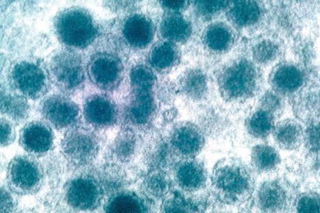 Fig. 1.44, Merkel cell granules: they are membrane bound and measure approximately 150 nm in diameter.