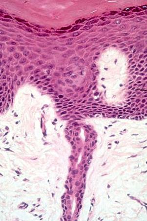 Fig. 1.60, Eccrine gland: high-power view of eccrine straight duct.