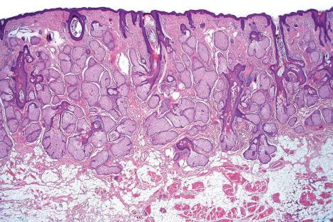 Fig. 1.6, Skin of the nose: there are conspicuous sebaceous glands: at this site, they often drain directly onto the skin surface. These appearances should not be confused with that of sebaceous hyperplasia.