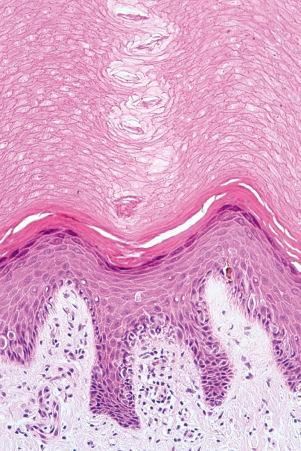 Fig. 1.61, Eccrine gland: most superficially, the duct coils through the stratum corneum.