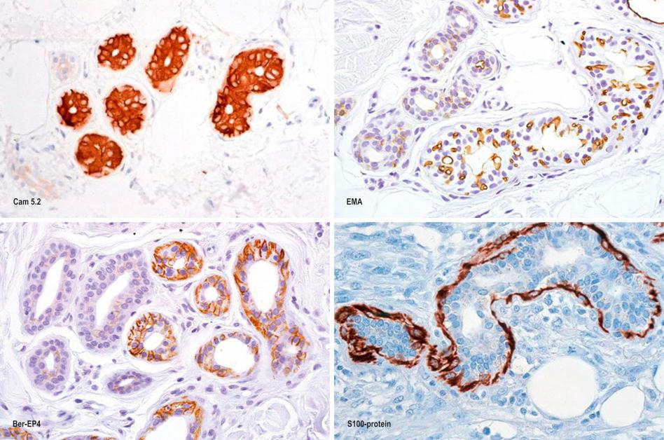 Fig. 1.63, Eccrine gland: immunohistochemistry.