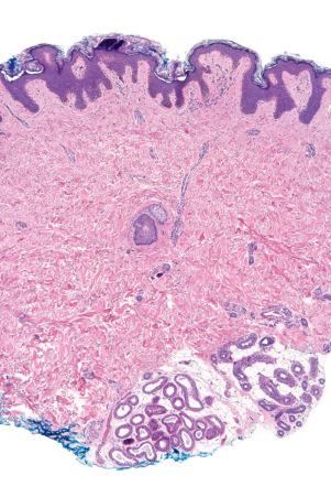 Fig. 1.9, Skin from axilla: apocrine glands as seen at the bottom of the field are typical for this site.