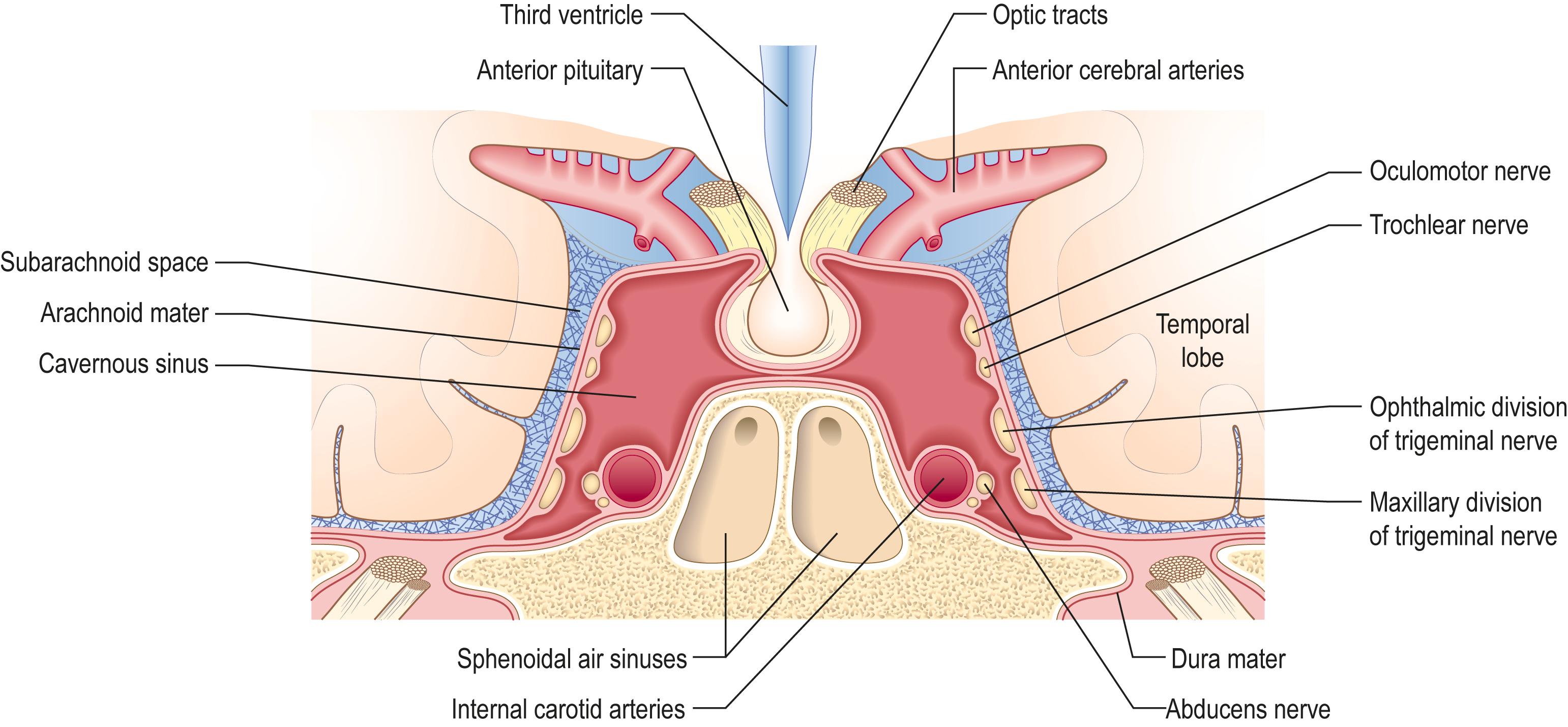 Fig. 8.3, Cavernous sinus (coronal view).