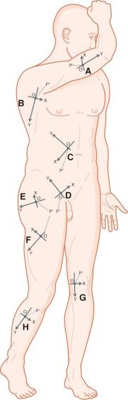 Figure 26.2, The XY plane of each specific donor site of the flap.