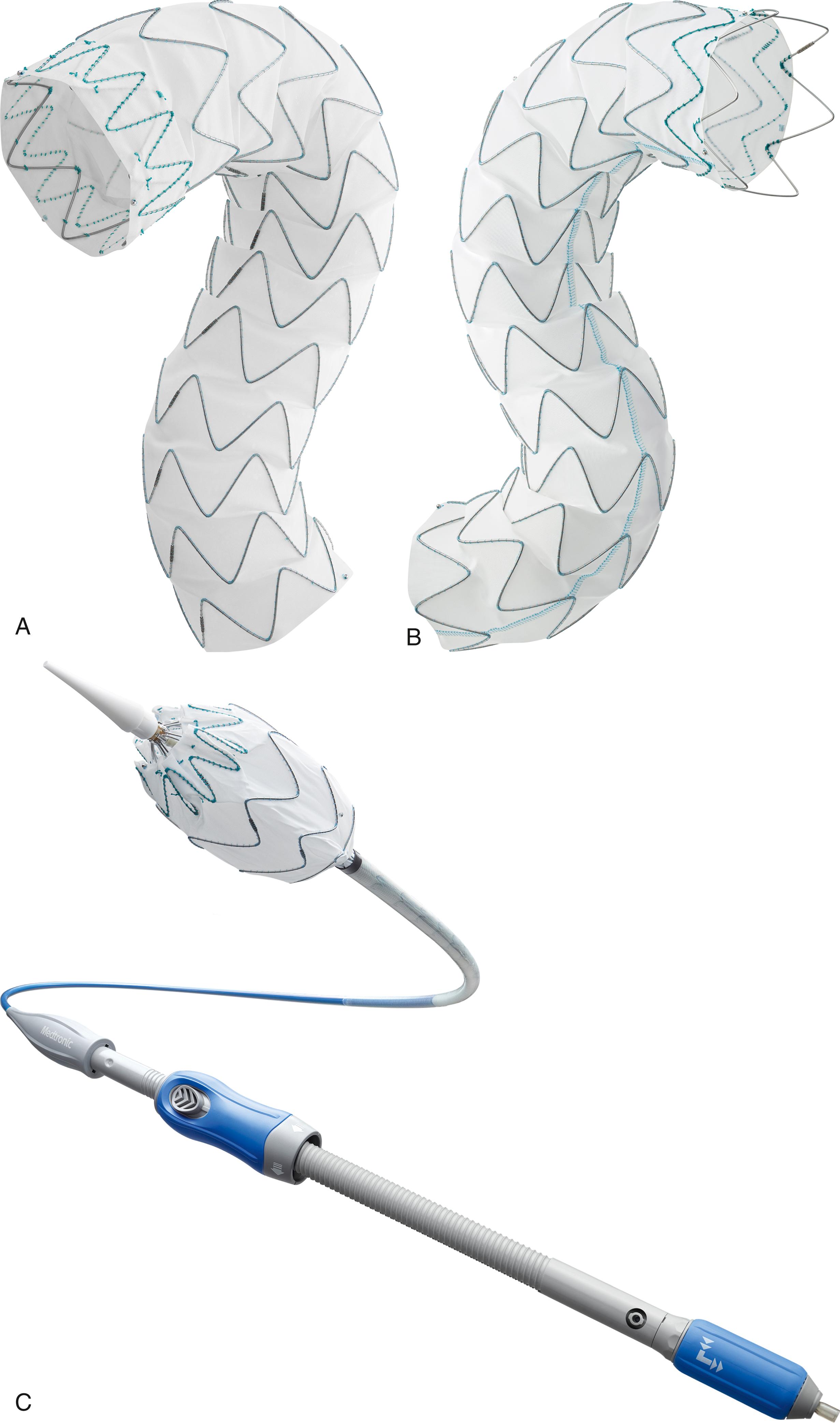 Figure 80.2, ( A ) Medtronic Valiant Navion Thoracic Stent Graft System Freeflo design. ( B ) Medtronic Valiant Navion Thoracic Stent Graft System CoveredSeal design. ( C ) Medtronic Valiant Navion Thoracic Stent Graft Delivery System with taper tip and short nosecone.