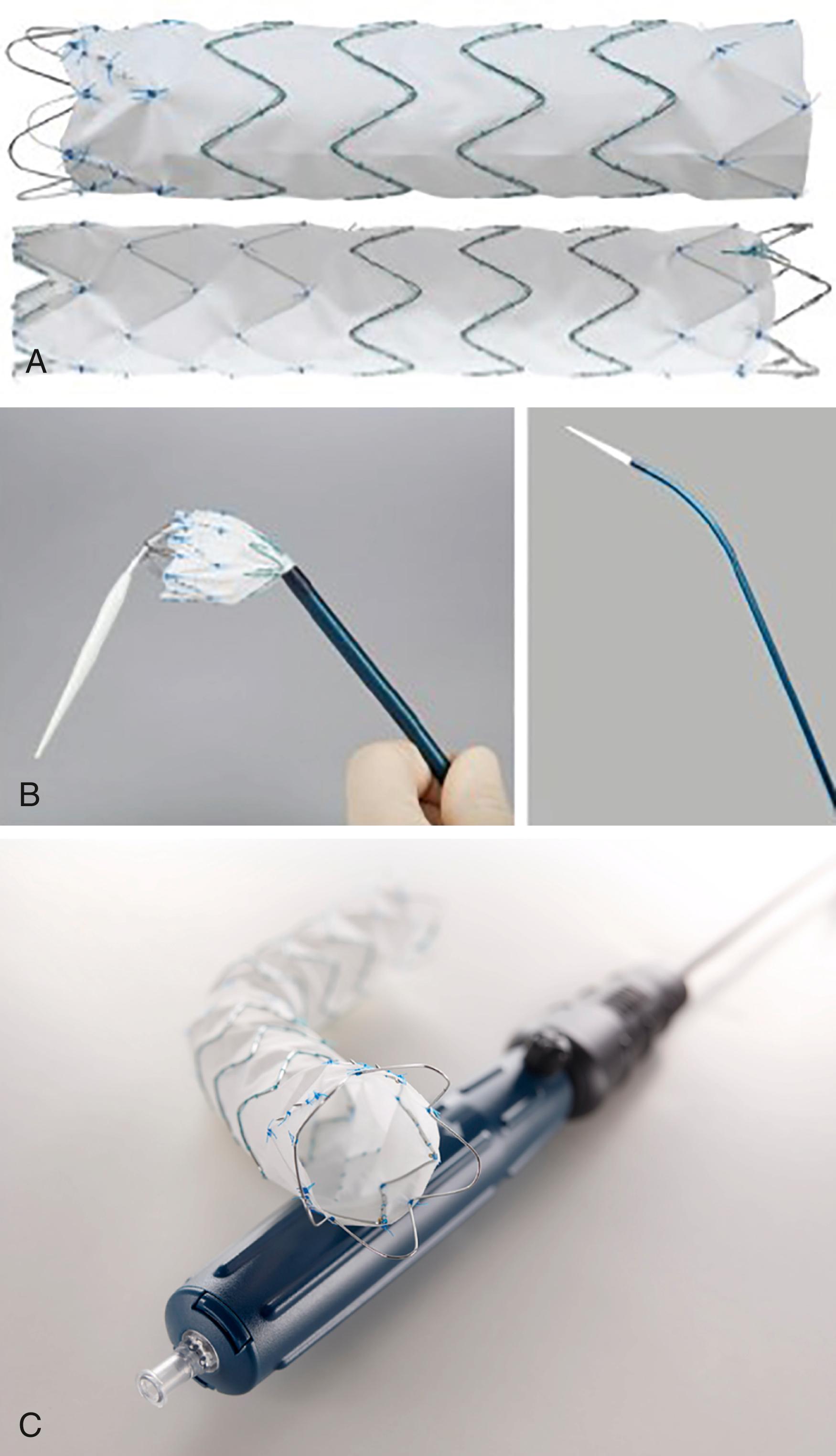 Figure 80.3, ( A ) Schematic of Cook endograft with Pro-Form modification with precurved inner cannular that improves proximal conformity and wall apposition. ( B ) Cook Zenith Alpha lower-profile thoracic endograft, proximal and distal components. ( C ) Cook Zenith Alpha lower-profile thoracic endograft handle. After endograft positioning and deployment the rotating blue handle releases the proximal constraining wires. Note the proximal open cell design to improve wall apposition.