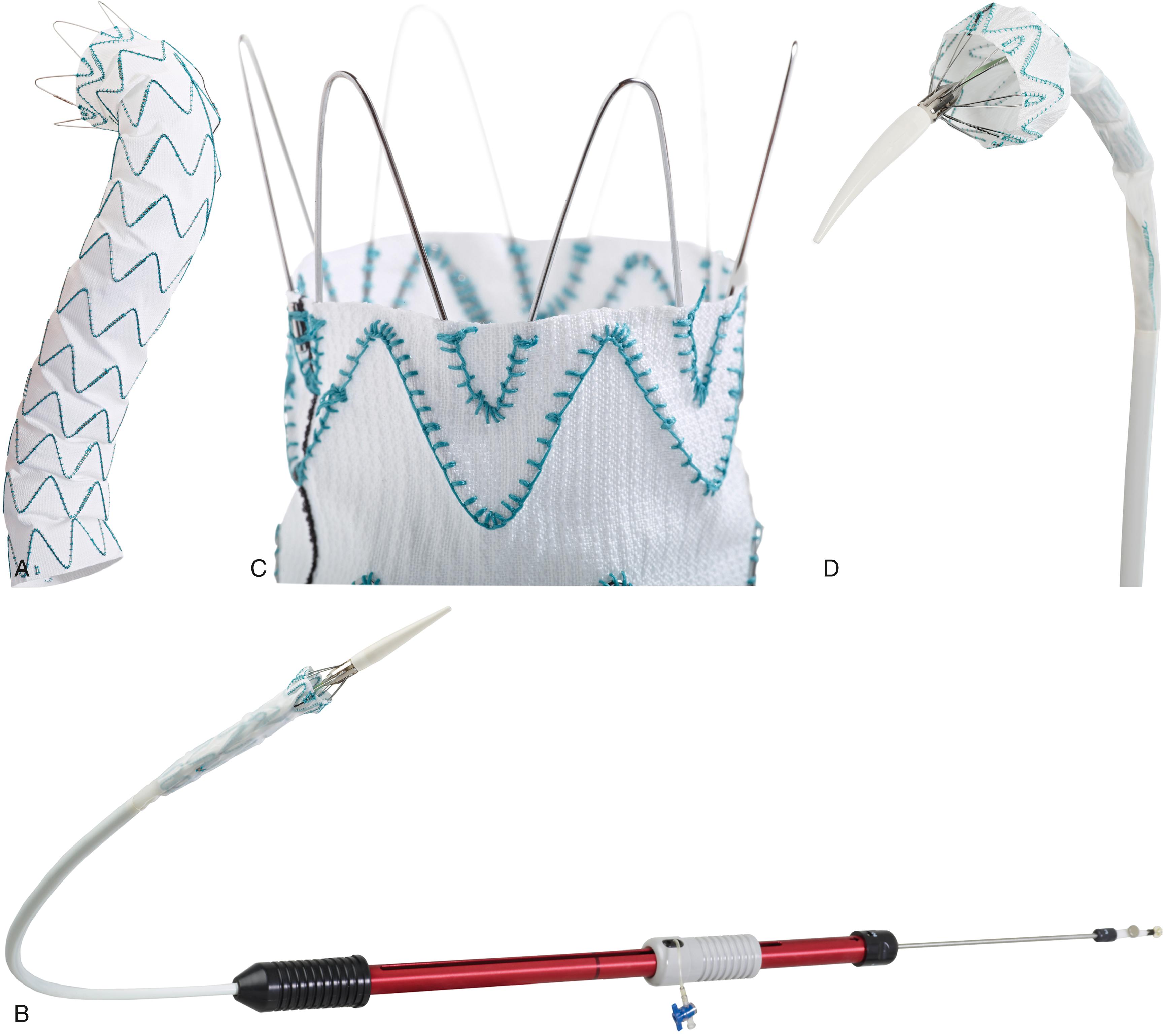 Figure 80.4, ( A ) Terumo Aortic Relay Plus device. Note the proximal bare stents on the Relay Plus device. ( B ) Terumo Relay Plus transport delivery system. The transport delivery system consists of a hydrophilic braided outer coaxial sheath, flexible secondary sheath with a through lumen that facilitates device advancement and precise endograft deployment. ( C ) Terumo Aortic Relay Plus close-up with bare stent design. Active proximal fixation is provided by bare stents on the Relay Plus device. ( D ) Terumo Aortic Relay Plus with constrained leading edge of the endograft.