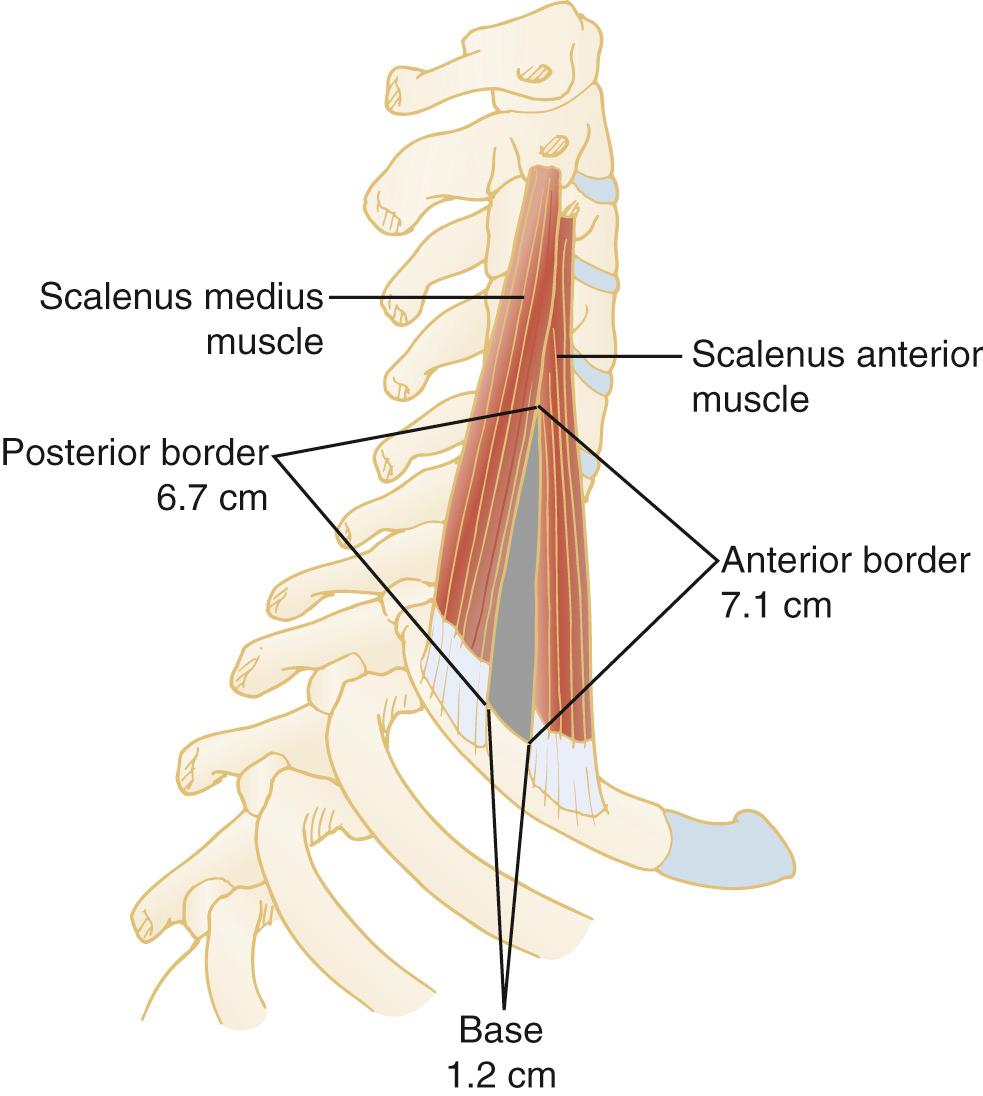 FIGURE 26-3, The scalene (anterior) triangle, with its measurements and the narrow interval through which the neurovascular bundle passes.