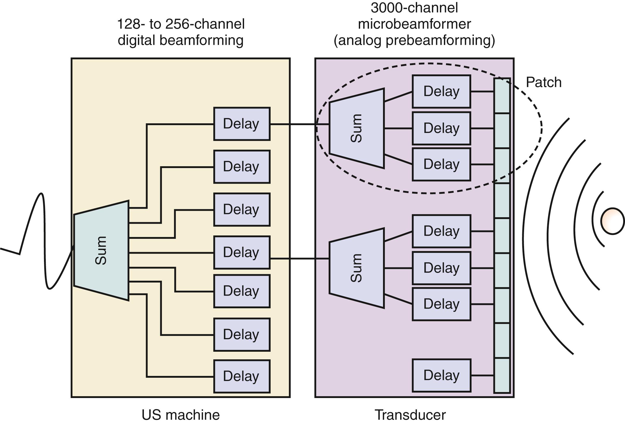 Figure 2.4, Three-dimensional (3D) beamforming. Beamforming with 3D matrix-array transducers has been split into two: the transducer and the ultrasound (US) machine levels. At the transducer level, interconnection technology and integrated analog circuits control transmit and receive signals using different subsection of the matrix (patches) to perform analog pre-beamforming and fine steering. Signals from each patch are summed to reduce the number of digital lines in the coaxial cable that connects the transducer to the ultrasound system from 3000 to the conventional 128 or 256 channels. At the ultrasound machine level, analog-to-digital (A/D) convertors amplify, filter, and digitize the elements signals, which are then focused (coarse steering) using digital delay (DELAY) circuitry and summed together (Ξ) to form the received signal from a desired object.