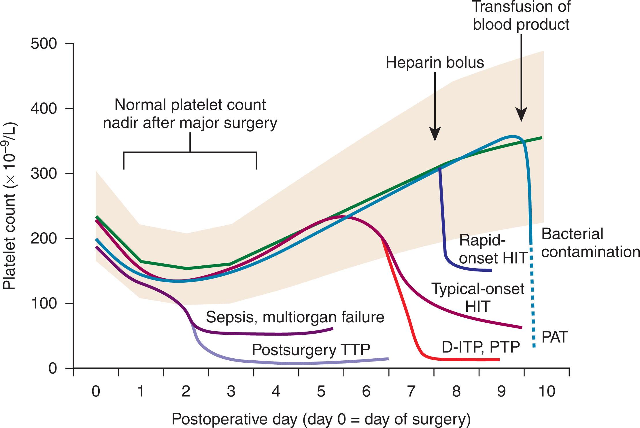 Figure 130.2, TIMING OF ONSET AND SEVERITY OF THROMBOCYTOPENIA: IMPLICATIONS FOR DIFFERENTIAL DIAGNOSIS.