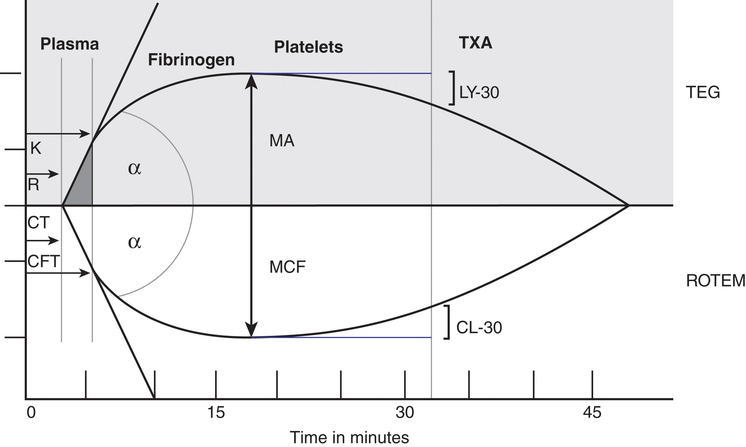 FIGURE 2, Comparison of viscoelastic parameters by thromboelastography (TEG) and rotational thromboelastometry (ROTEM). R, Reaction time, from test initiation to beginning of clot formation; K, K time, represents clot kinetics and is calculated from the start of clot formation until curves reach 20 mm amplitude; alpha-angle, angle between baseline and tangent to curve through the starting point of the clot, reflects acceleration of clot formation; MA, maximal amplitude, direct measure of the apex on the thromboelastography curve and represents overall clot strength, via interactions of platelets and fibrin; LY-30, the percentage of clot lysis at 30 minutes after maximum clot strength achieved; CT, clotting time from the addition of reagent until clot initiation; CFT, clot formation time, the time from CT until a clot firmness of 20 mm is reached; MCF, maximum clot firmness, the greatest vertical amplitude of the tracing, represents similar attributes as MA, namely platelet and fibrinogen contribution to clot strength; ML, maximum lysis, the fibrinolysis of > 15% as identified relative to the MCF; CL-30, clot lysis at 30 minutes; TXA, tranexamic acid.