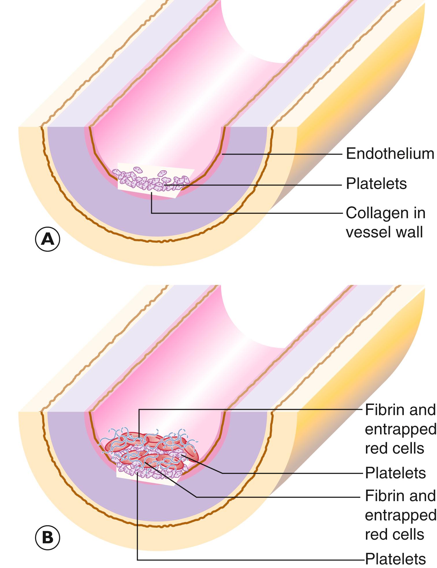 Fig. 9.1, Early thrombogenesis.