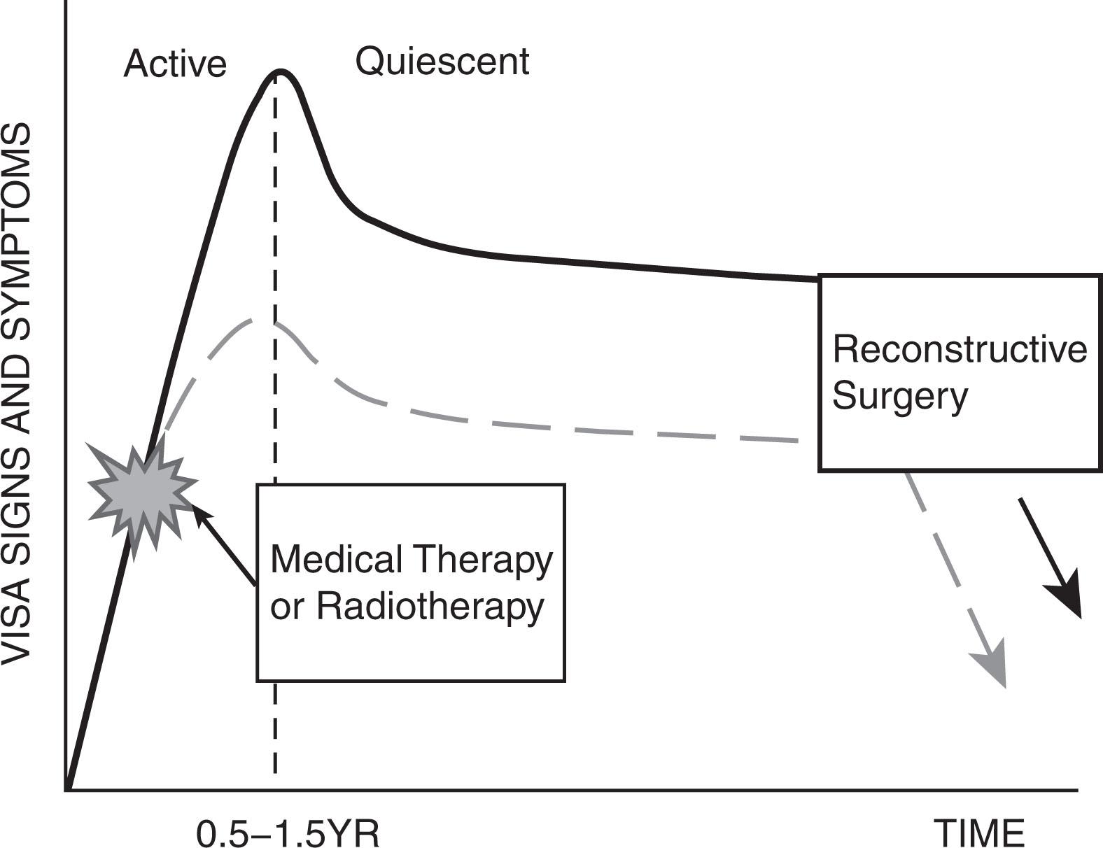 Fig. 12.13.4, Rundle Curve Plots Disease Severity (y-Axis) Versus Time (x-Axis), With an Active, Progressive Phase Followed by an Inactive, Stable Phase.