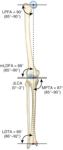 FIG 26-14, The normal tibiofemoral coronal alignment.