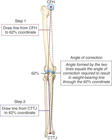 FIG 26-18, The method used to calculate the correction angle of a high tibial osteotomy using a full-length anteroposterior radiograph of the lower extremity. The lines from the centers of the femoral head (CFH) and tibiotalar joint (CTTJ) converge in this example at the 62% coordinate.