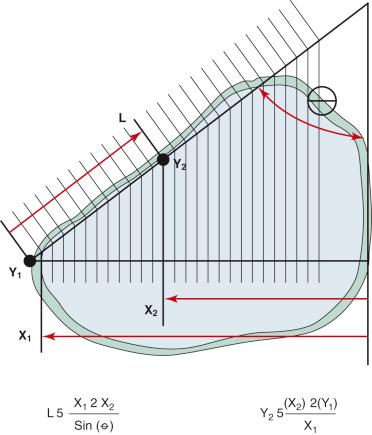 FIG 26-32, Vertical gap measurements of the opening wedge osteotomy are a function of distance from the hinge axis of the lateral tibial cortex for the opening wedge (X 1 , X 2 ), oblique angle of the anteromedial tibial cortex (⊖), and distance along the osteotomy site L.