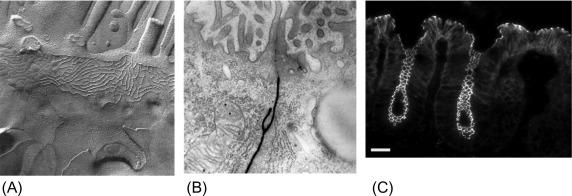 Fig. 25.3, (A) Freeze-fracture electron microscopic replica of the TJ region of mouse jejunum, showing the interconnected network on claudin-based strands crossing the membrane. Continuous rows of claudins from adjacent cells adhere and seal the paracellular space. Above the barrier contact zone a few apical microvilli are visible. (B) Transmission electron micrograph of the apical junction complex region of two adjacent mouse mammary epithelial cells, rotated at 90° around a vertical axis to the image in (A). Lanthanum hydroxide (black) was added to the basolateral side; it freely diffuses through the intercellular space until it is partially blocked at the TJ from reaching the apical side. The TJ is recognized as a region of very close cell-cell apposition. Microvilli are seen on the apical surfaces. (C) Immunofluorescent microscopic localization of the TJ protein ZO-1 in mouse distal colon. The epithelial surface is at the top and two crypts are visible descending toward the bottom of the image. ZO-1 at the TJ is visible at the apical end of the lateral cell contacts, from crypt to surface. Tangential sectioning in the crypt reveals the continuous circumferential location of TJs around each cell. Bar, 10 μm.