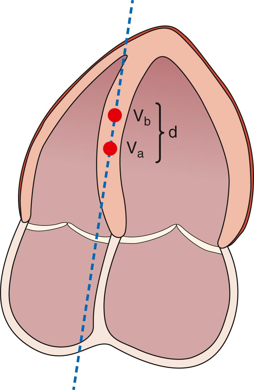 Figure 4.1, From the apical four-chamber view, strain rate from the interventricular septum is measured from two neighboring velocity points (V a and V b ) located with a known distance (d) apart along the ultrasound beam.