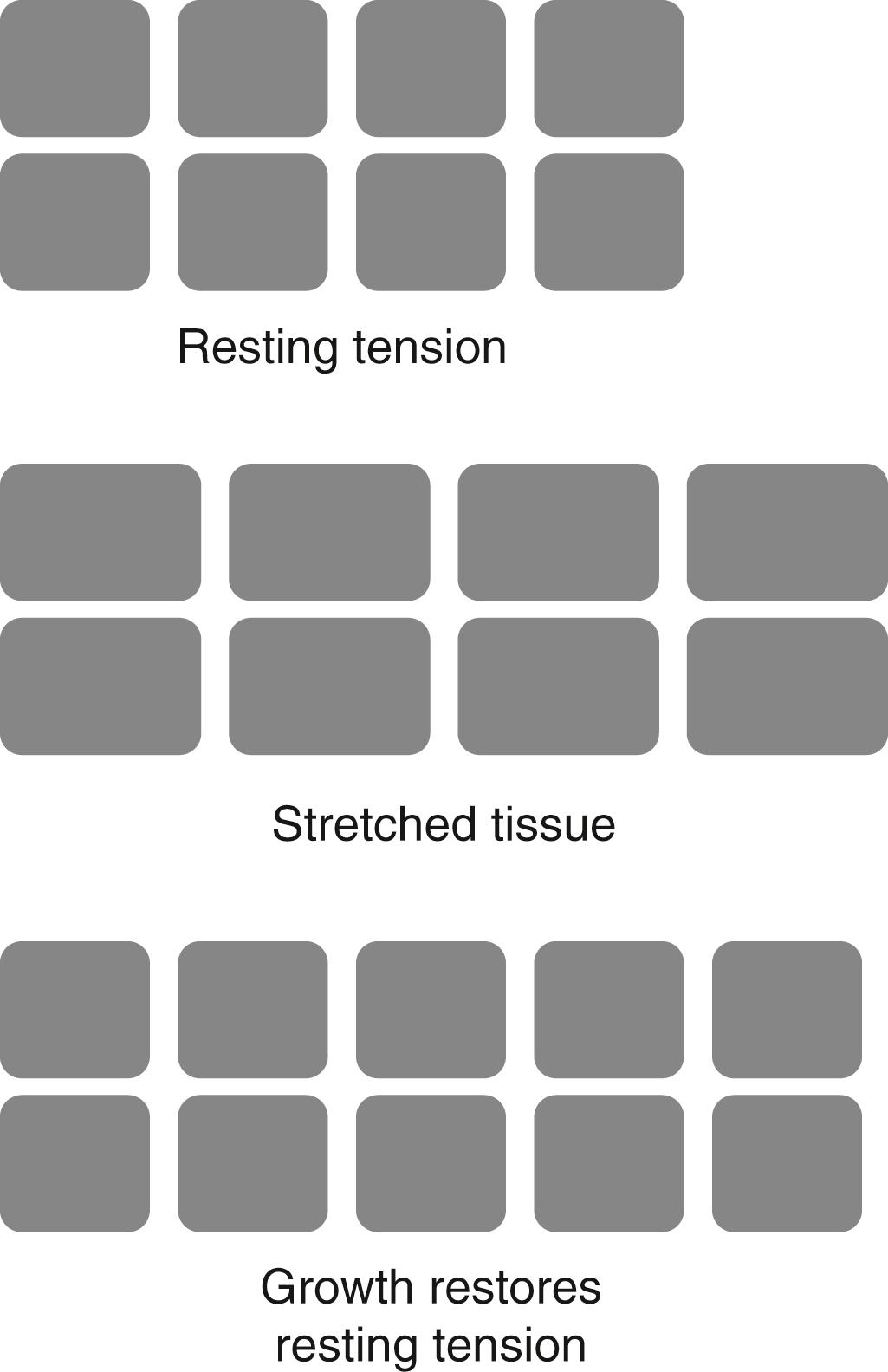 Tissue Expansion Clinical Tree