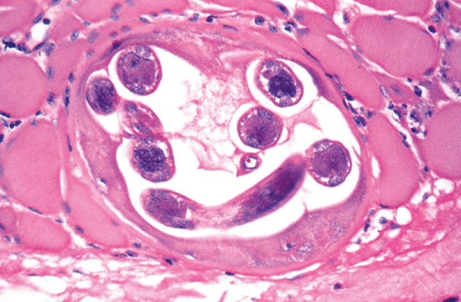 FIG. 287.1, Coiled Trichinella spiralis larvae within a skeletal muscle cell.