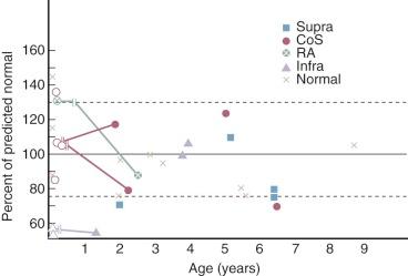 Figure 31-2, Preoperative left ventricular end-diastolic volume, expressed along vertical axis as percent of predicted normal according to age and cardiac morphology. Dashed horizontal lines enclose ±2 SD from mean normal value. Open symbols represent preoperative values in seven patients, and closed symbols represent postoperative values. When both values were measured in the same patient, symbols are connected by solid lines, with two short vertical parallel lines indicating time of repair. X represents values in normal patients. Key: CoS, Coronary sinus total anomalous pulmonary venous connection (TAPVC); Infra, infracardiac TAPVC; RA, right atrial cardiac TAPVC; Supra, supracardiac TAPVC.