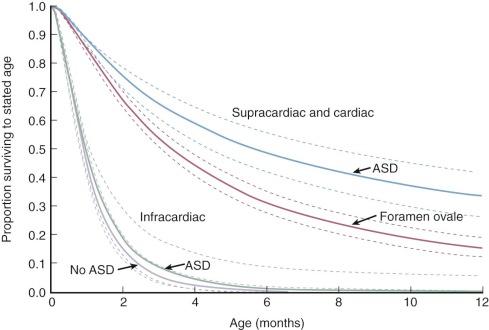 Figure 31-8, Nomogram of multivariable equation relating survival of surgically untreated persons with total anomalous pulmonary venous connection ( n = 183) to type of connection and presence or absence of an atrial septal defect (ASD). Survival was not different for supracardiac and cardiac types. Solid lines represent probabilities; dashed lines represent 70% confidence limits. The separation into ASD and foramen ovale groups was based simply on words used in autopsy protocol, under the presumption that atrial septal defect denoted larger holes.