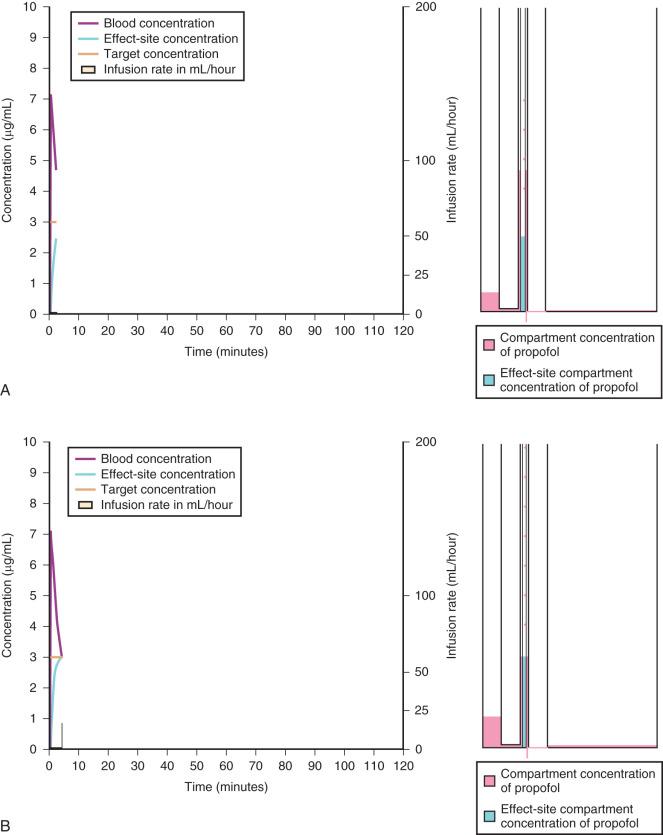 FIGURE 8.9, A, Hydraulic model representation of effect-site TCI. Compartment volumes and intercompartmental clearance values for the Paedfusor model in a healthy 10-kg, 1-year-old infant. In the first few minutes the central compartment to effect-site concentration gradient is marked to “overpressure” the transfer of propofol to the effect site. The peak blood concentration is 7.1 µg/mL. Distribution from the central compartment (C1) to the first peripheral compartment (C2) occurs rapidly also, which slows the rise in effect-site concentration and blood concentration. Elimination from C1 and distribution from C1 to the second peripheral compartment (C3) is also occurring. B, At 4.5 minutes, the effect-site concentration has reached the target of 3 µg/mL and has equilibrated with the concentration in C1. The infusion device, which has been off after the initial loading infusion, now switches back on to maintain the effect-site target concentration at 3 µg/mL. C, After 1 hour of maintenance at an effect-site concentration of 3 µg/mL, the target is set to 0 µg/mL and the pump switches off. A total of 14 mL of propofol (1%) has been administered, or 14 mg/kg. There is now a considerable accumulation of propofol in C2 and C3, while C1 and the effect site are still in equilibrium. D, Approximately 10 minutes after the effect-site target concentration is set to 0, the blood concentration has halved; thus the context-sensitive half-time is 10 minutes. The lag in the decline in effect-site concentration is clearly seen, and there is now a gradient between effect site and C1. There is now also a concentration gradient from C2 to C1 and to C3 and this slows the decline in the concentration in C1. E, One hour after the infusion is stopped, the blood and effect-site concentrations have fallen to of the maintenance effect-site concentration. There are still considerable quantities of propofol in compartments C2 and C3 that slow the decline of the concentration of C1 and effect-site concentrations. F, Even after 4 hours, the depot of propofol in C2 and C3 is considerable, although blood and effect-site concentrations are extremely low. However, these low concentrations may still be exerting significant antiemetic and anxiolytic effects (data from the Paedfusor pharmacokinetic data set).