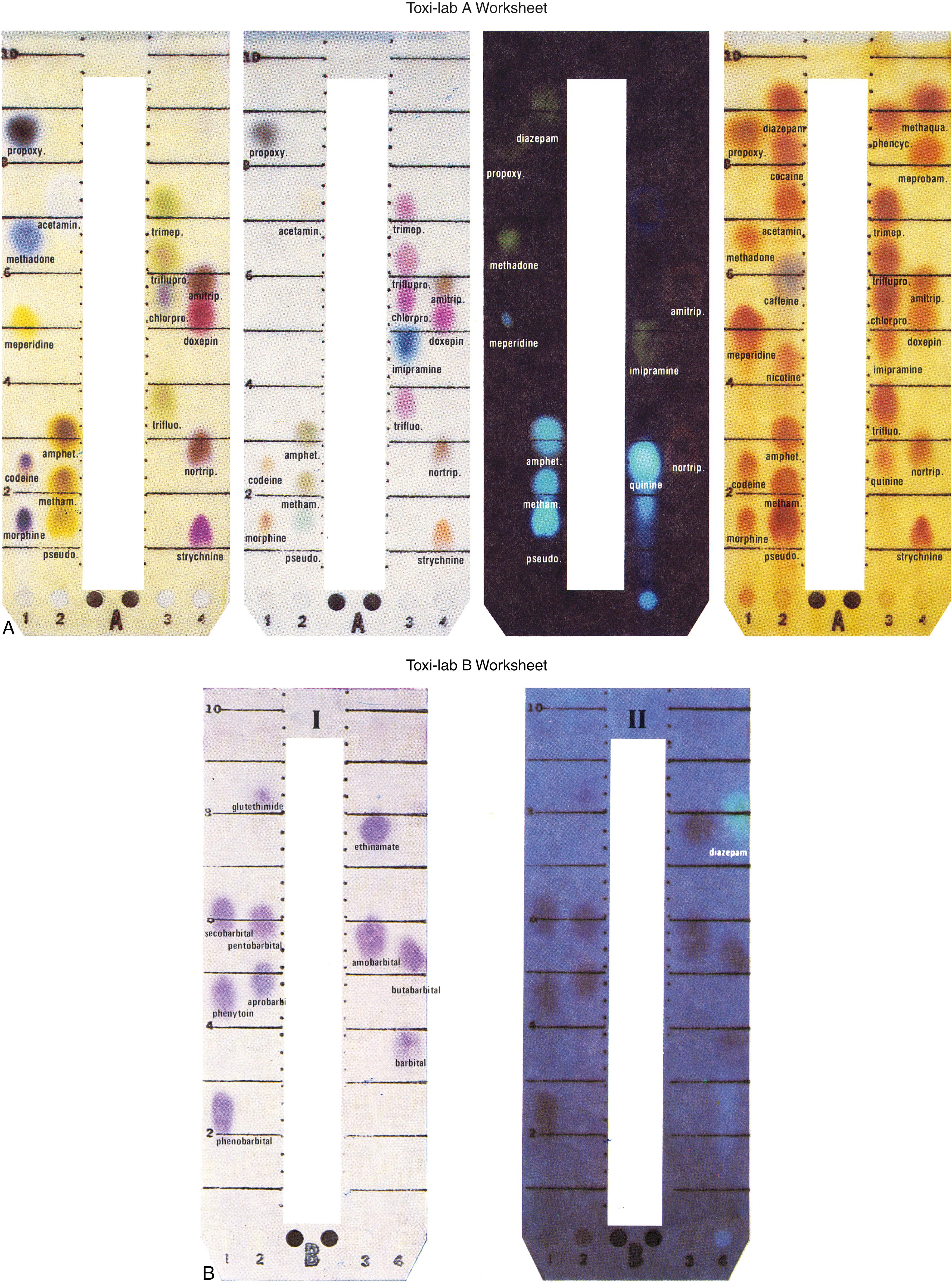 Figure 24.3, A set of typical separations of the major drugs of abuse (and some therapeutic drugs) on Toxi-Lab thin-layer chromatography. Toxi-Lab A worksheet: Typical separation of basic drugs on the A strip, together with characteristic color changes. The third Toxi-Lab A strip shows characteristic fluorescence of different drugs. Note that amphetamine and methamphetamine on the lower left are both fluorescent. Toxi-Lab B worksheet: Left: Typical separation of the more acidic drugs on the B strip with characteristic color changes. The major use of the B strip is to identify the presence of barbiturates. Right: Fluorescence patterns of drugs on the B strip.