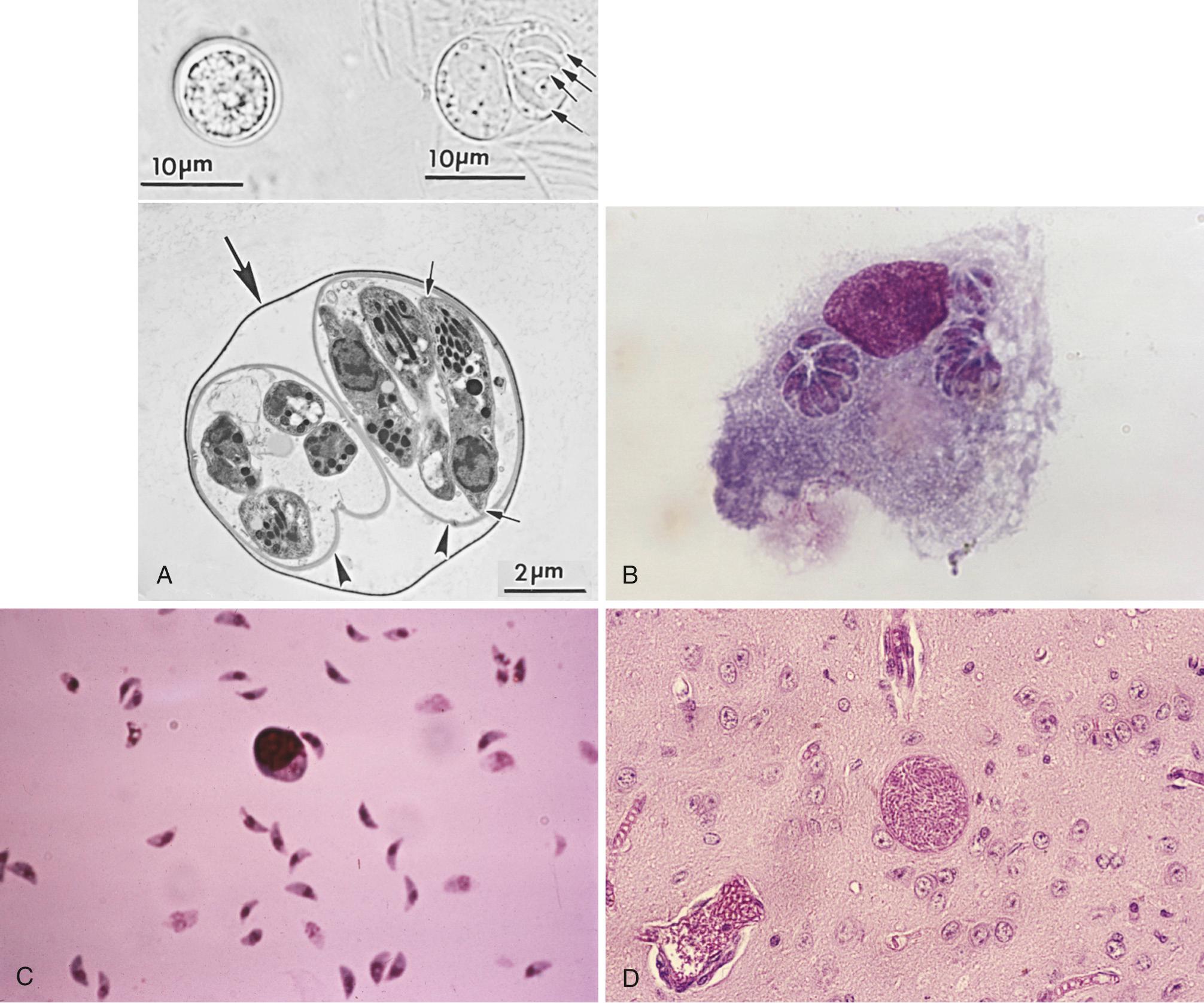 FIG. 278.1, The three forms of Toxoplasma gondii observed in nature.