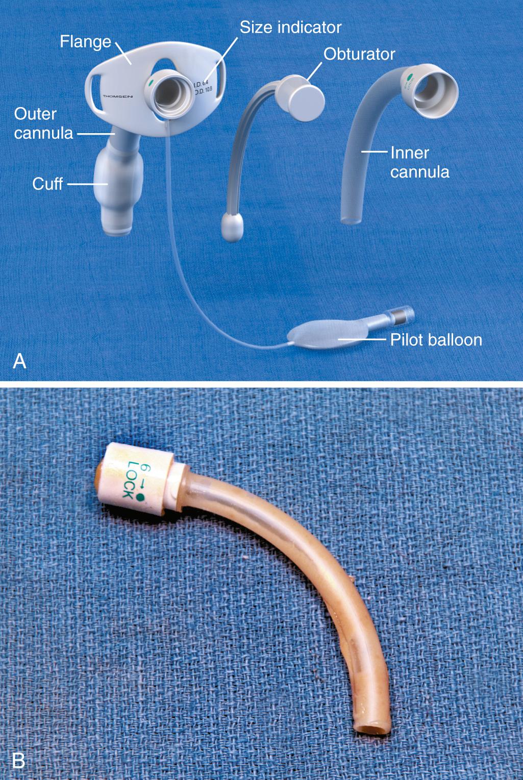 Figure 7.3, Shiley tracheostomy tube. A, The obturator is placed inside the tube (while the inner cannula is removed) to facilitate insertion through the stoma. The inner cannula must be inserted into the tube to ventilate the patient. B, The inner cannula should always be in place and removed only for daily cleaning. An inner cannula clogged with mucus and debris, as seen in this figure, is the most common cause of respiratory distress in patients in the emergency department.