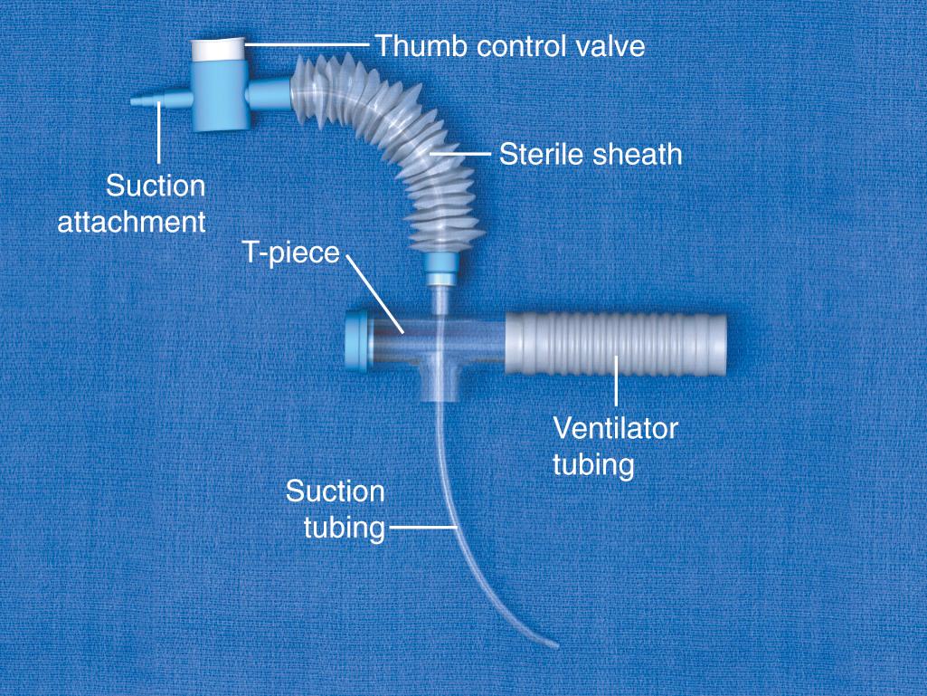 Figure 7.5, Closed-system suction catheter.