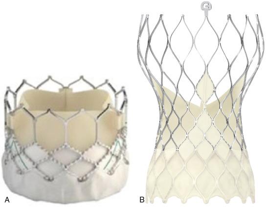 Fig. 12.1, Available Transcatheter Valves.