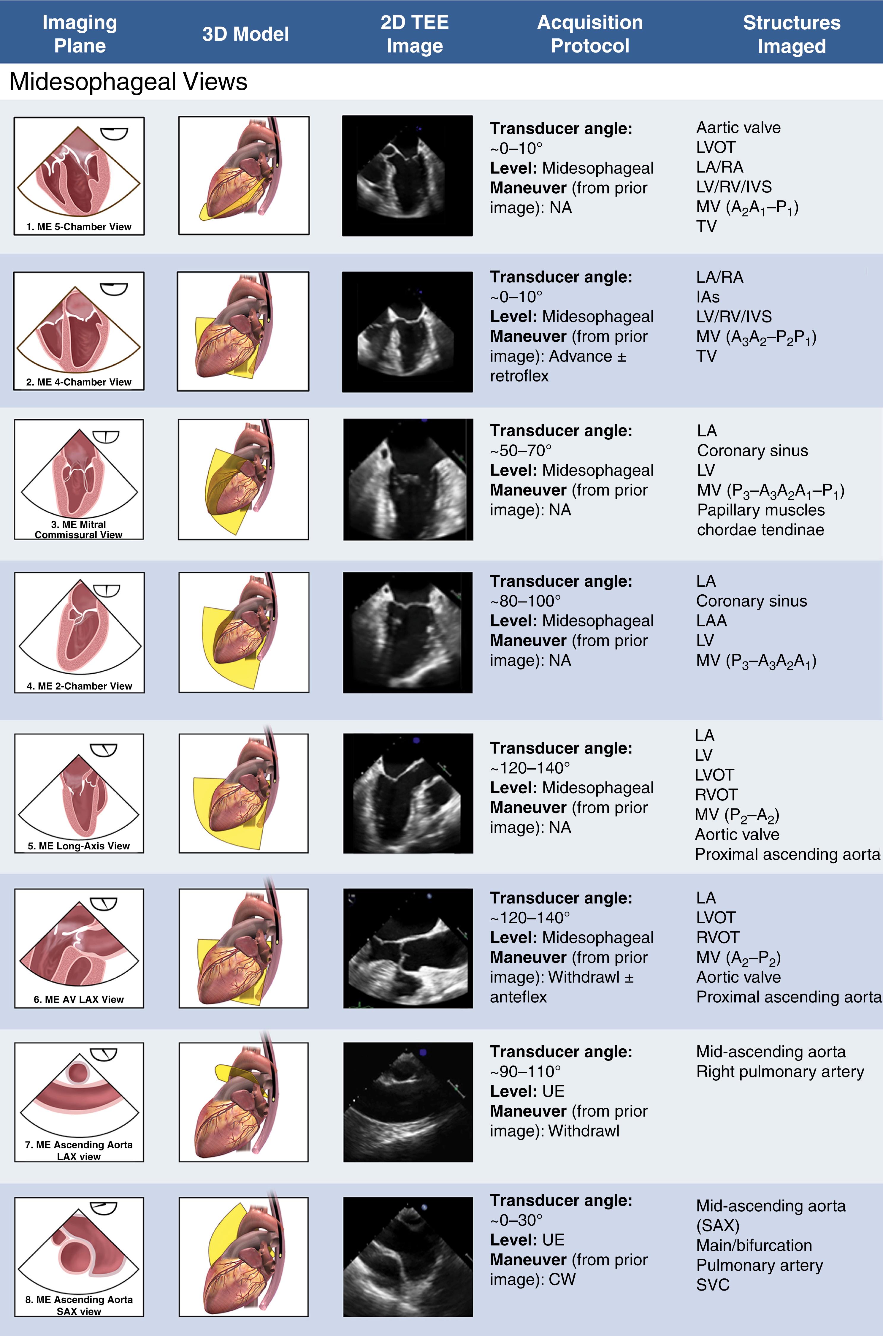 Figure 13.1, Imaging views 1 through 8 (midesophageal level) of the comprehensive transesophageal echocardiographic examination. The first column shows the tomographic view of the image. The second column shows the position of the transesophageal probe. The third column shows the two-dimensional image of the view. Column 4 describes the acquisition protocol with each successive view working from the prior view. Column 5 lists the structures imaged in each view. See text for abbreviations.