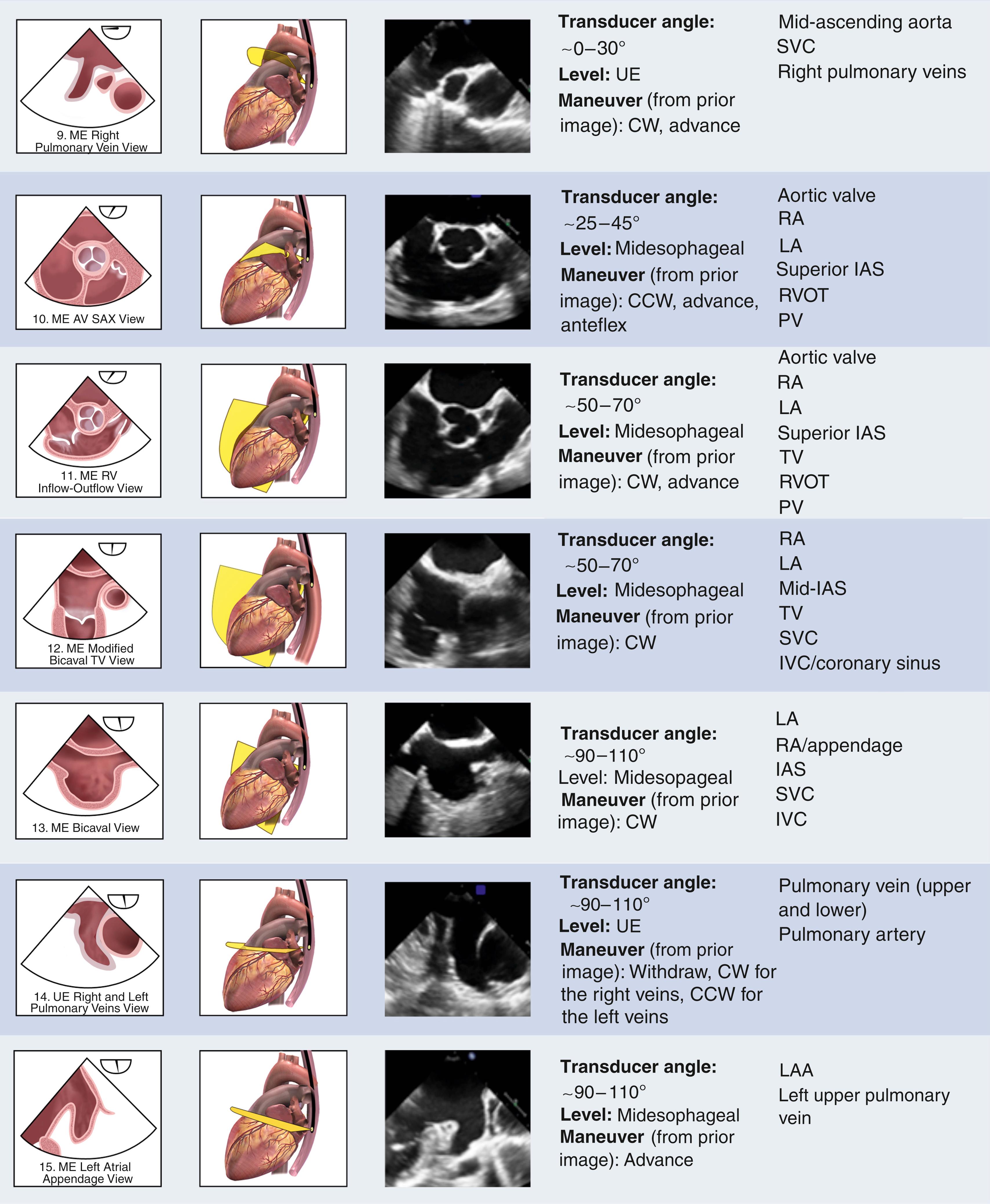 Transesophageal Echocardiography Tomographic Views Clinical Tree 