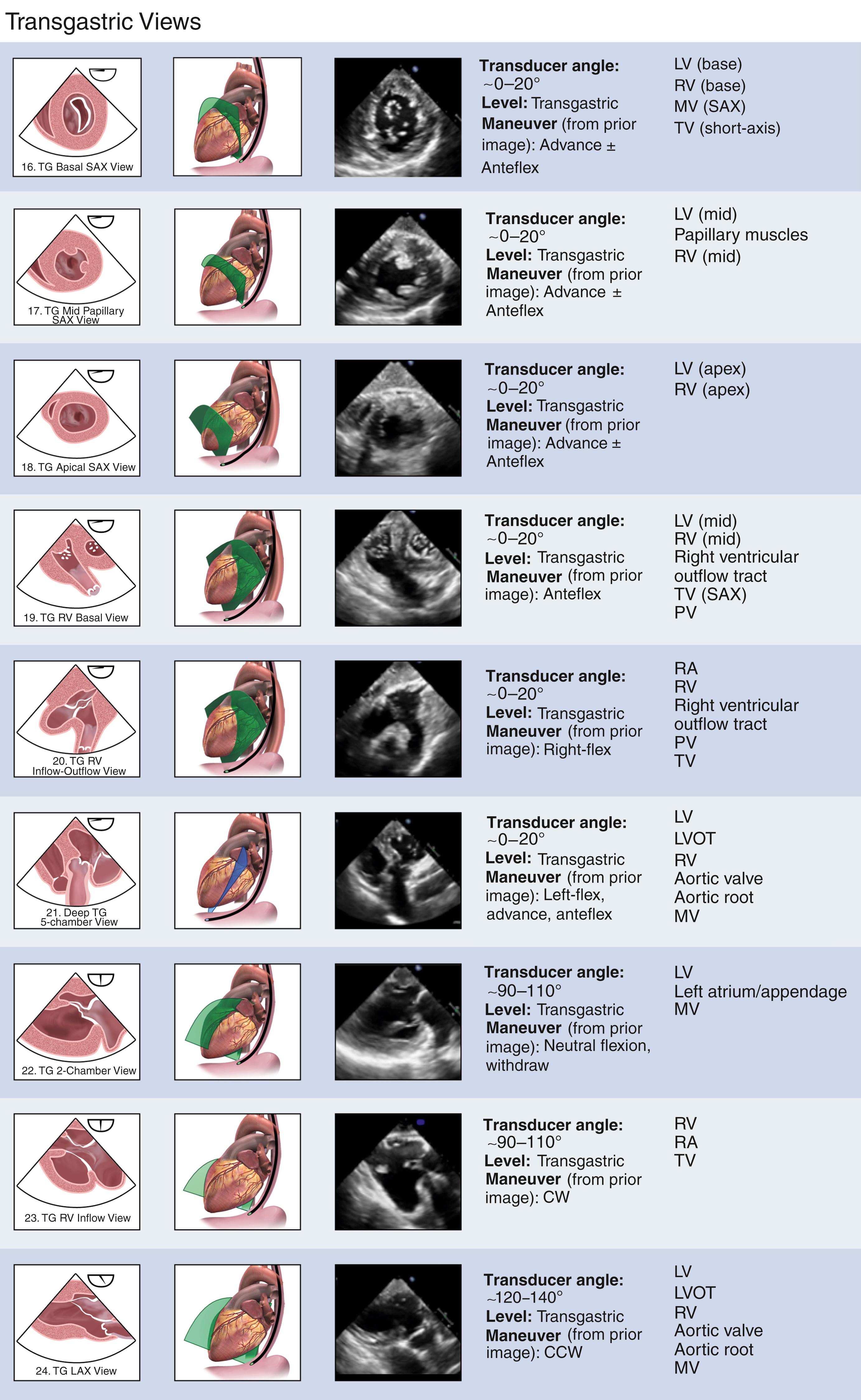 Figure 13.3, Imaging views 16 through 24 (transgastric level) of the comprehensive transesophageal echocardiographic examination. See Fig. 13.1 for further description. See text for abbreviations.