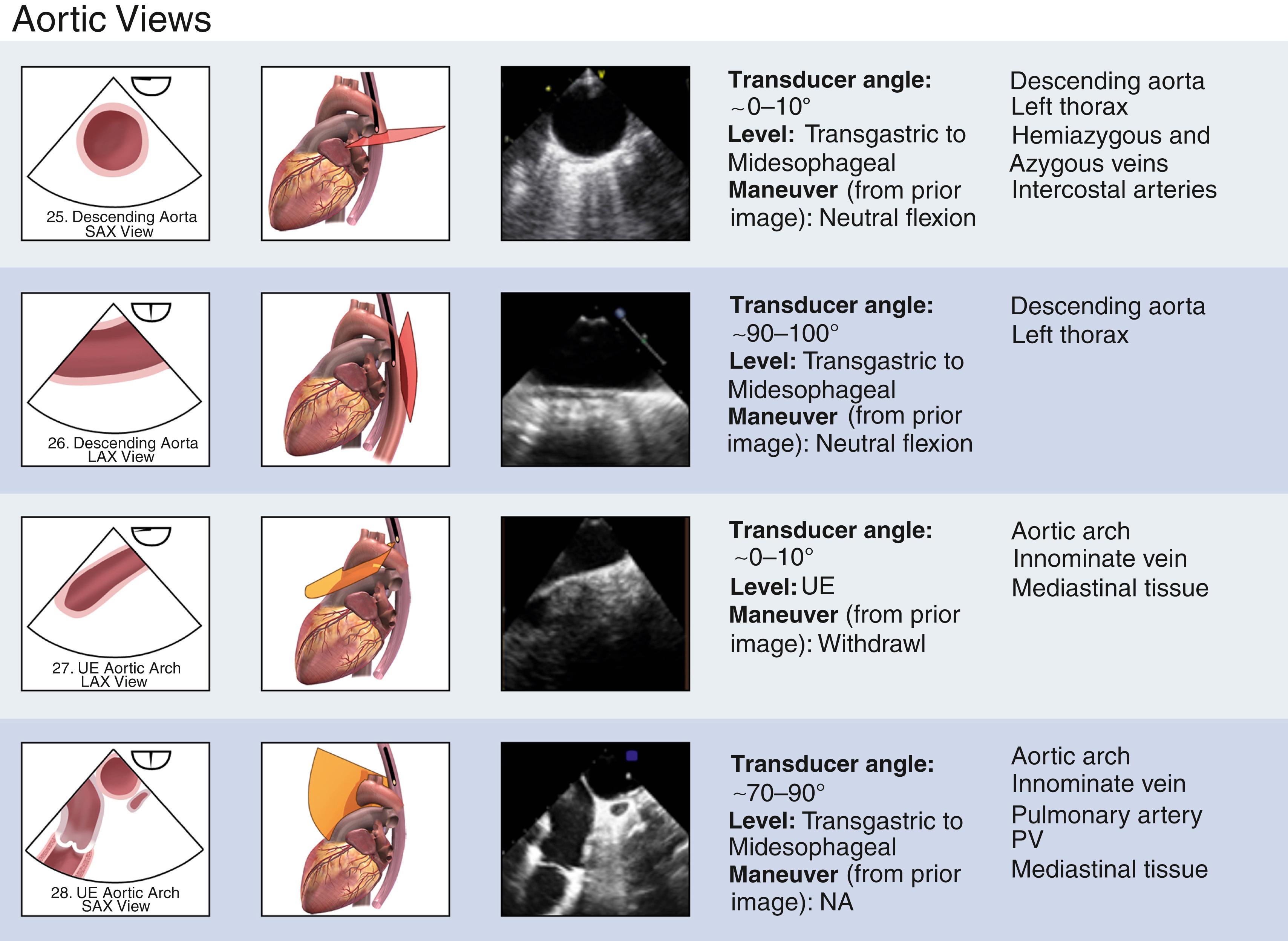 Figure 13.4, Imaging views 25 through 28 (aortic views) of the comprehensive transesophageal echocardiographic examination. See Fig. 13.1 for further description. See text for abbreviations.