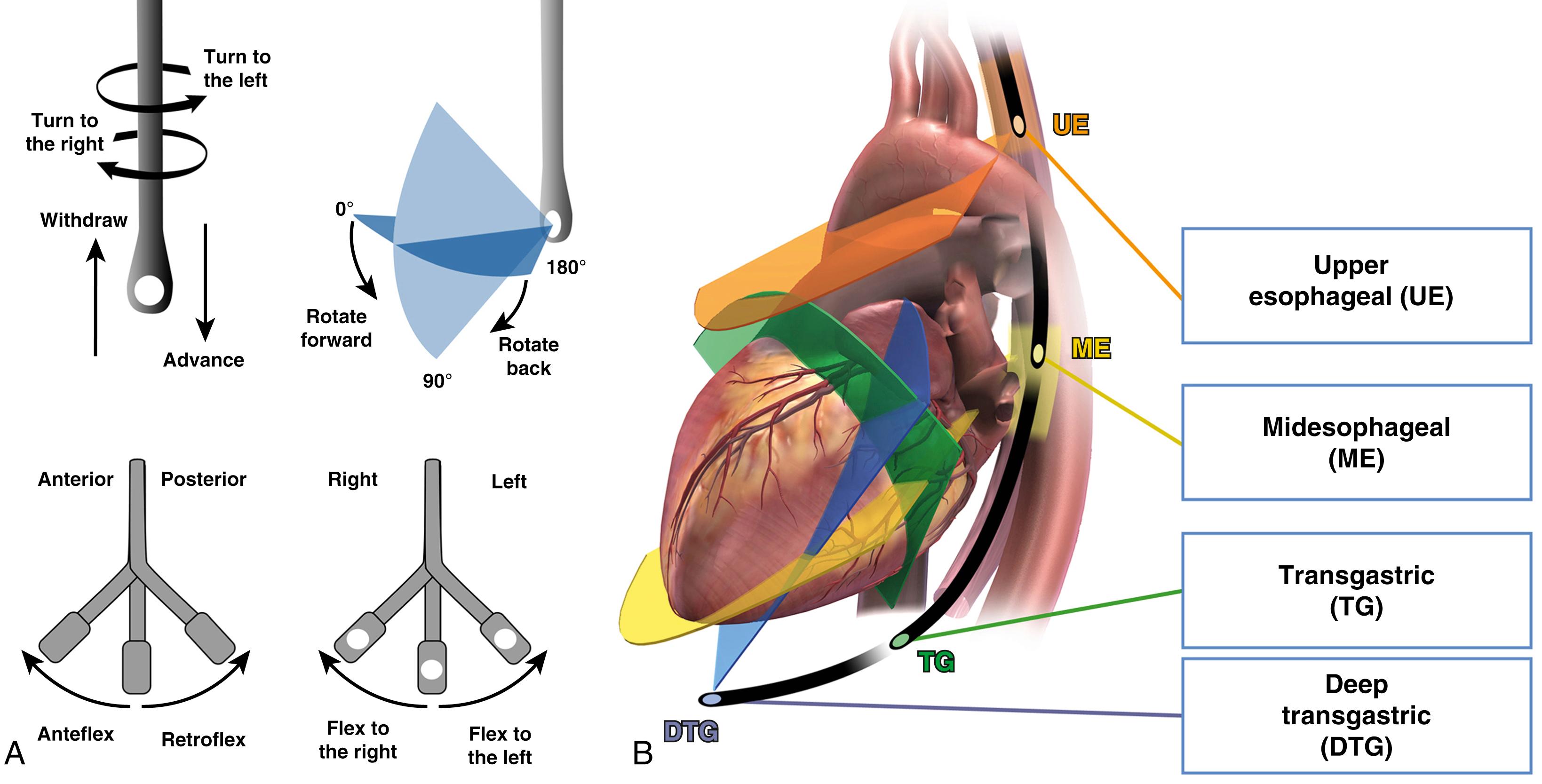 Figure 13.5, Description of probe manipulation and levels of imaging. A, The five probe manipulations that are used for a comprehensive transesophageal echocardiographic examination. B, The four standard levels of probe position.