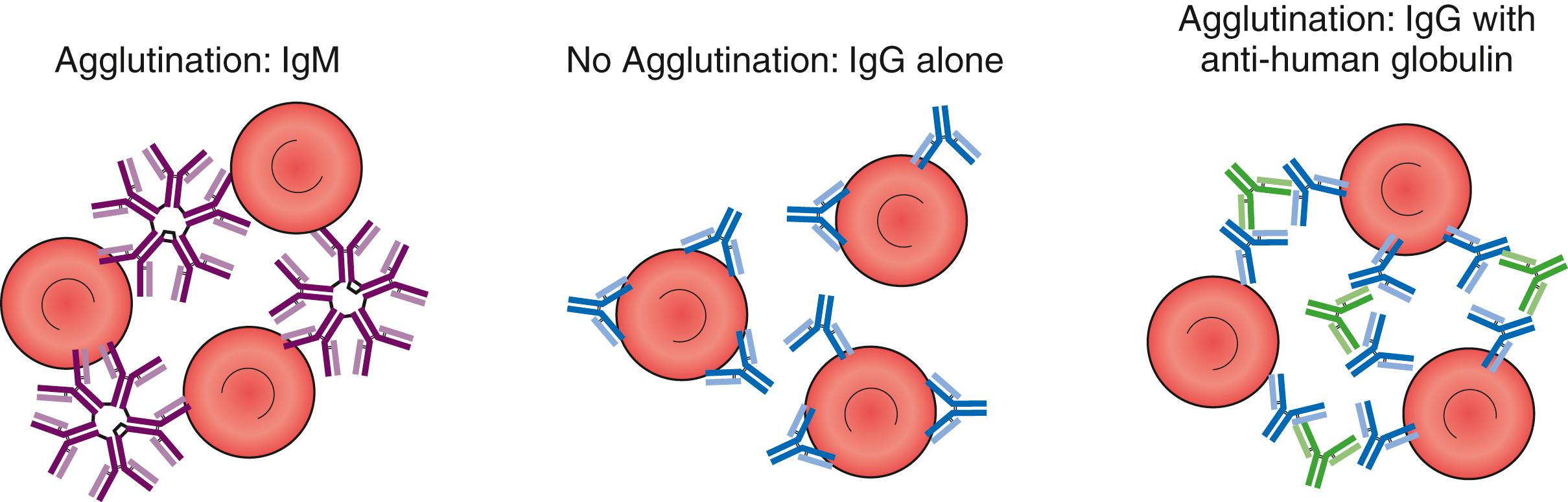 Fig. 19.8, Anti-human globulin. Ig, immunoglobulin.