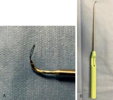 FIG. 14.16, (A, B) A 25-degree curved Suture Lasso (Arthrex, Inc., Naples, FL) useful for margin convergence and for U- and L-shaped tears.