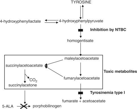 FIGURE 27-2, The metabolic pathway for tyrosine degradation. Note the proximal site of action of 2-nitro-4-trifluoromethylbenzoyl-1,3-cyclohexanedione (NTBC), which blocks formation of the toxic metabolites. The site of the enzymatic defect is also shown. ALA , Aminolevulinic acid.