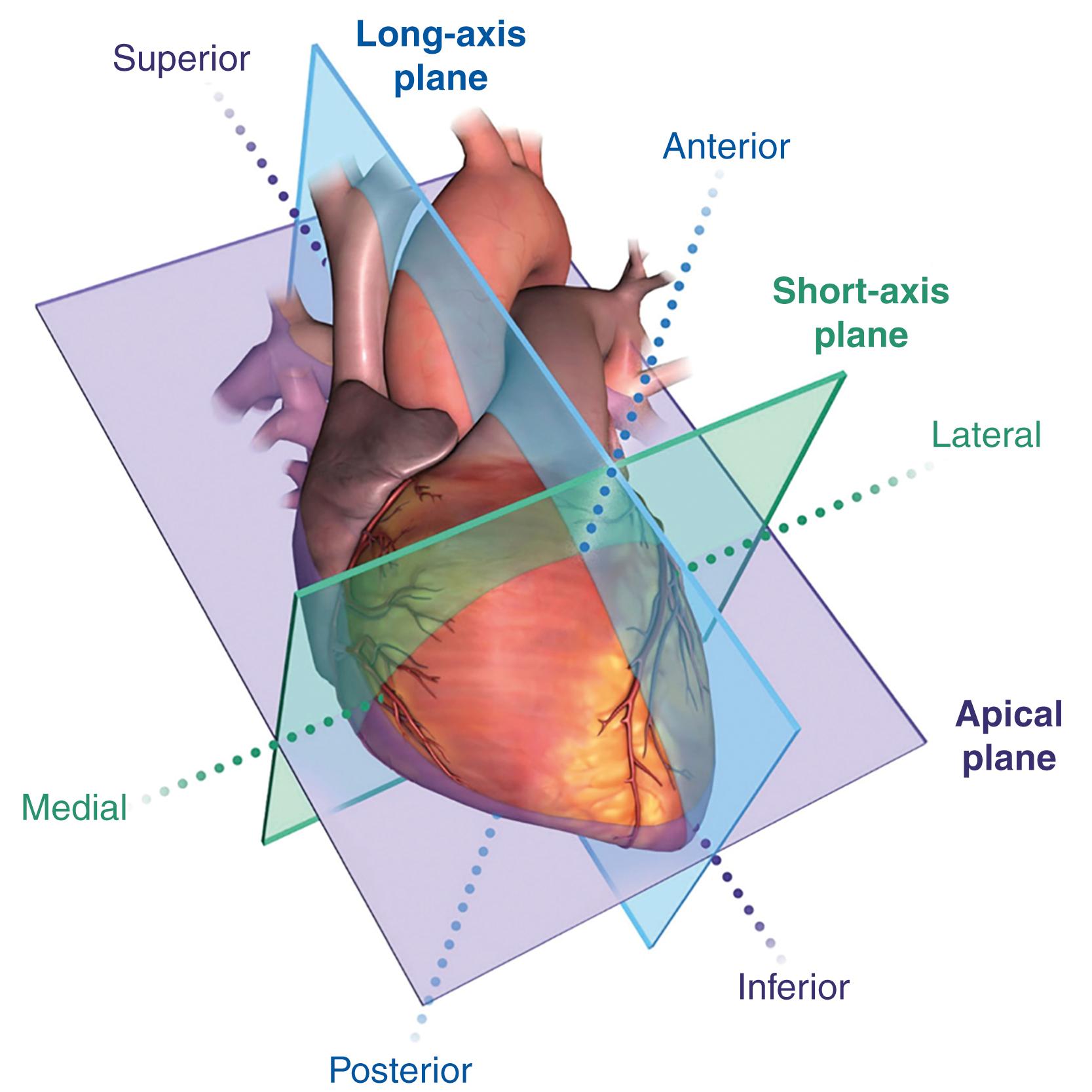 Figure 7.1, Imaging planes of the heart. Long-axis (blue) , short-axis (green) , and apical (purple) views.